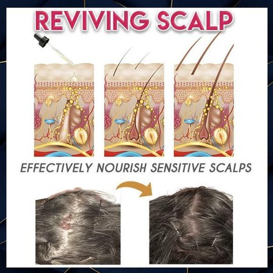 Pure Grow hajnövesztő esszencia - Image 2