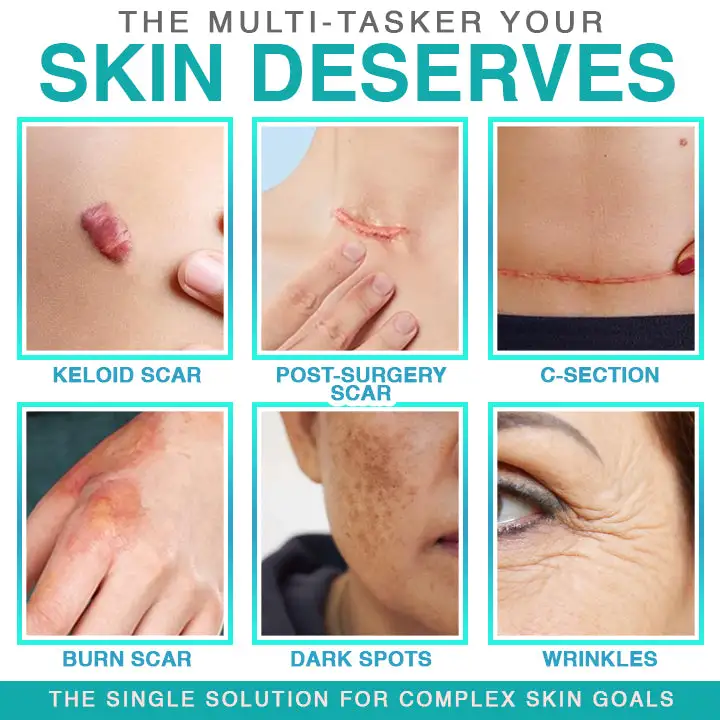 𝗖𝗮𝗿𝗲𝗕𝗿𝗲𝗲𝘇𝗲® 3 az 1-ben mikrotűs ápoló tapasz - Image 2