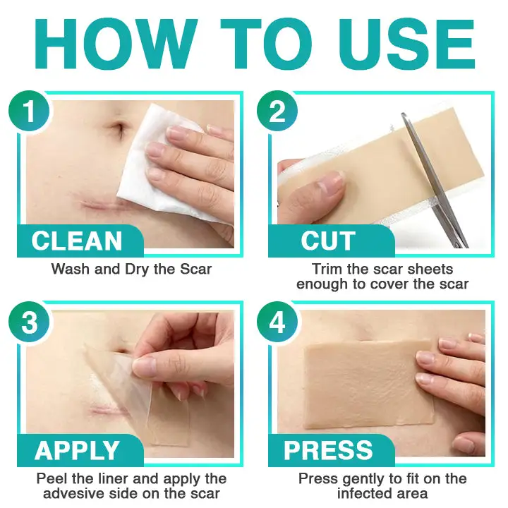 𝗖𝗮𝗿𝗲𝗕𝗿𝗲𝗲𝘇𝗲® 3 az 1-ben mikrotűs ápoló tapasz - Image 7