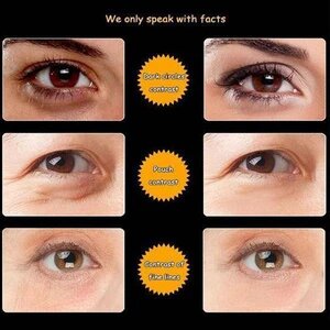 Kígyóméreg szemkörnyékápoló krém - Image 5