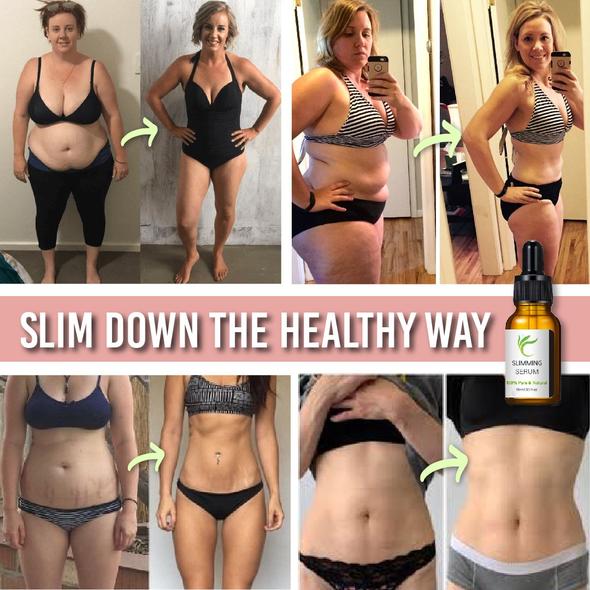 Hasplasztika öv zsírégető szérummal - Image 6