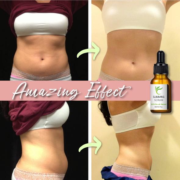 Hasplasztika öv zsírégető szérummal - Image 7