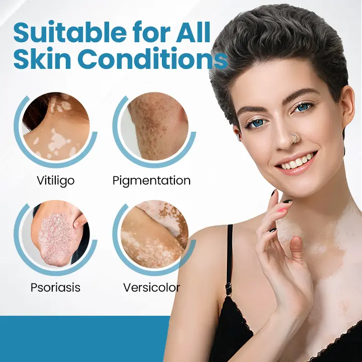Acezozla® DermaBeam Vitiligo terápiás készülék - Image 2