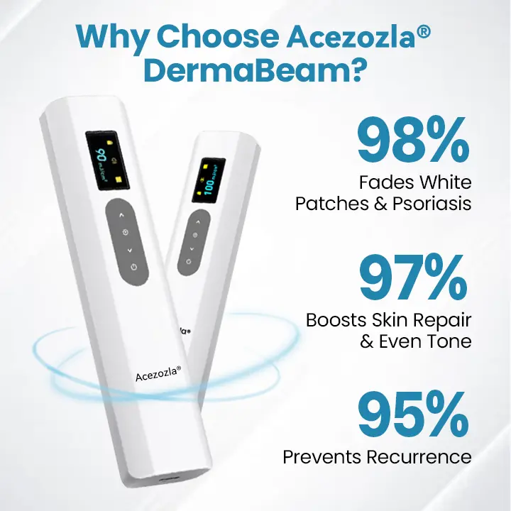 Acezozla® DermaBeam Vitiligo terápiás készülék - Image 6