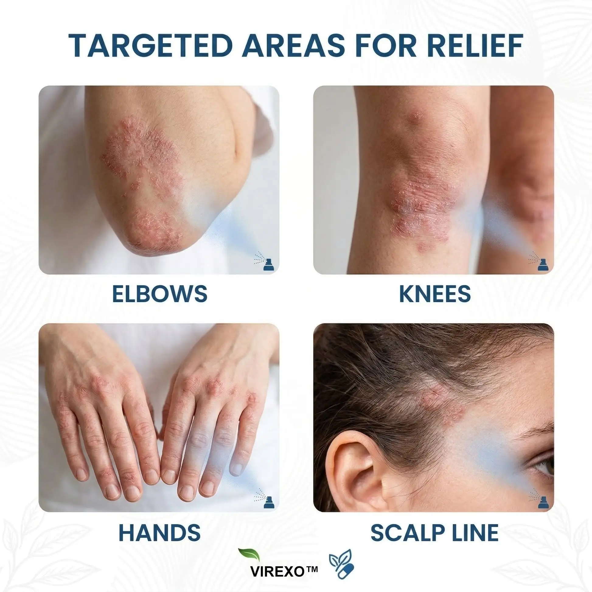 Virexo™ Magnesium Botanical Spray - Image 2