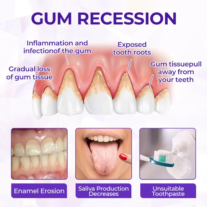 Virexo™ SensiGum fluoridos fogkrém - Image 8