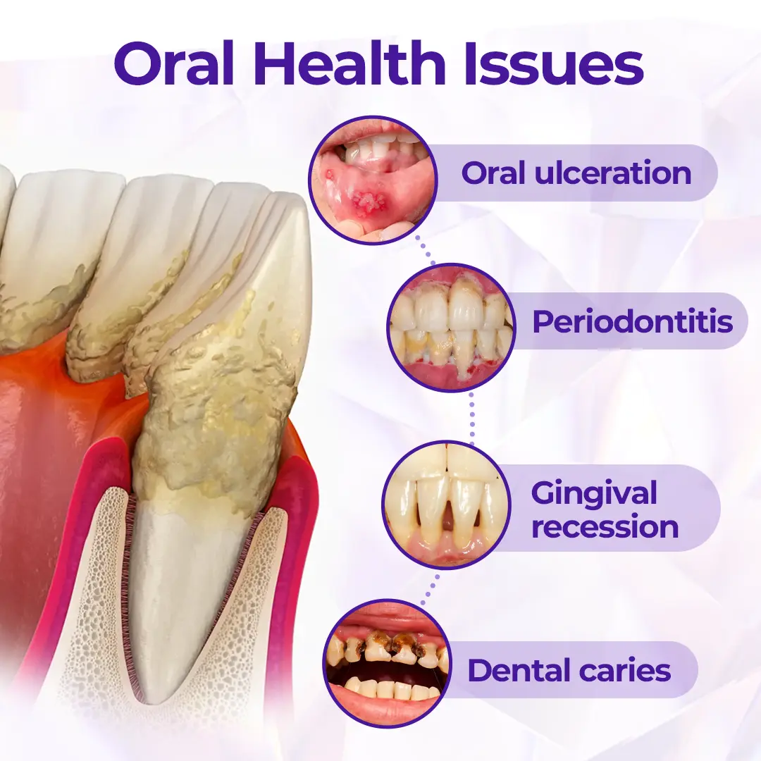 Virexo™ SensiGum fluoridos fogkrém - Image 9